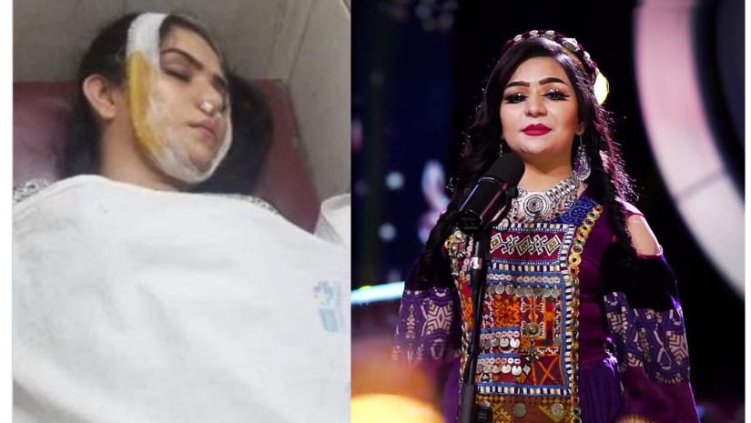 আফগানিস্তান